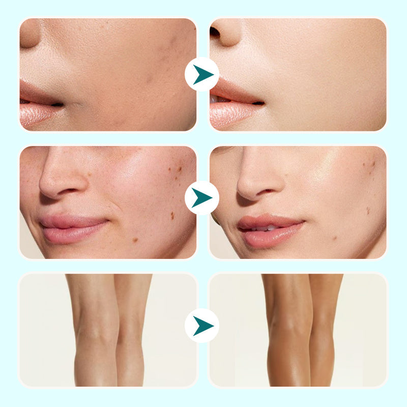 💜LETZTER TAG – KAUF 1, ERHALTE 1 GRATIS💜Feuchtigkeitsspendende Concealer-Wasserfeste Creme für Frauen