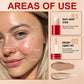 💖Black-Friday-Mega-Angebot – 1 + 1 GRATIS🎁 Zweifarbiger Langhaltiger Leichter Concealer